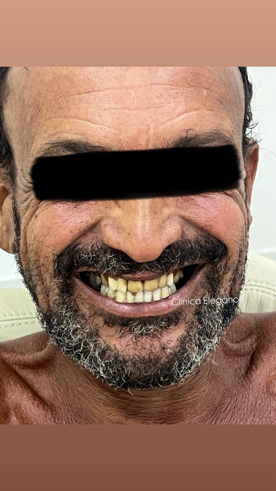 Sorriso - Antes